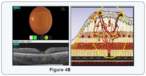 Click here to view Large Figure 4B