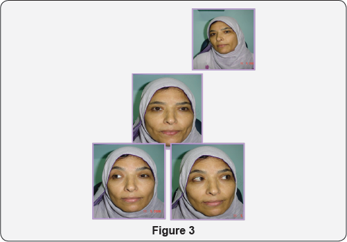 Click here to view Large figure 3