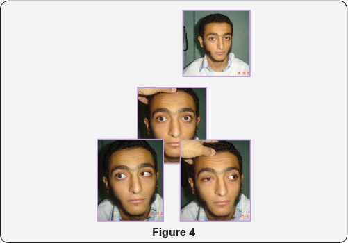 Click here to view Large figure 4