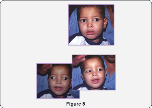 Click here to view Large figure 5