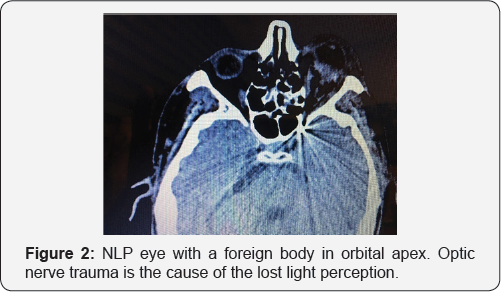 Click here to view Large Figure 2