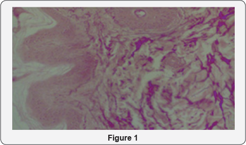 Click here to view Large Figure 1