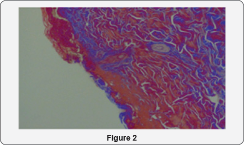 Click here to view Large Figure 2