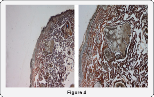 Click here to view Large Figure 4