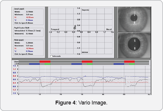 Click here to view Large Figure 4