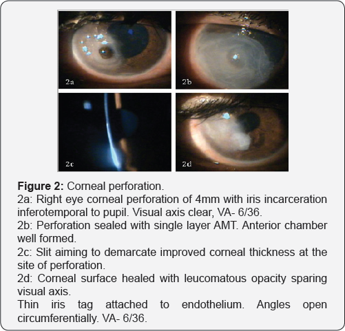 Click here to view Large Figure 2