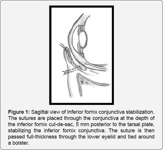 Click here to view Large Figure 1