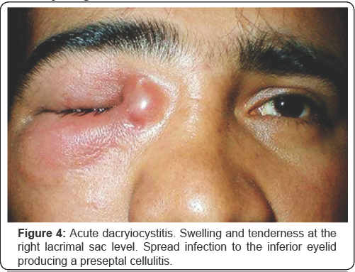 Click here to view Large Figure 4