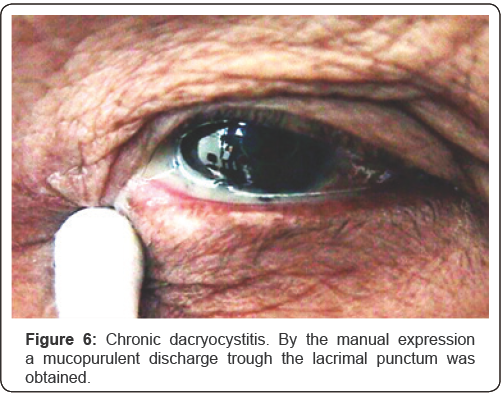 Click here to view Large Figure 6