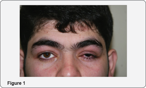 Click here to view Large Figure 1