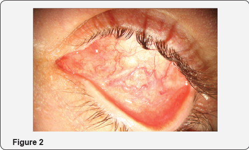 Click here to view Large Figure 1