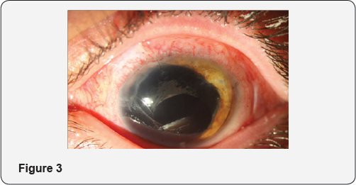 Click here to view Large Figure 1