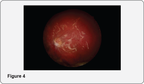 Click here to view Large Figure 1