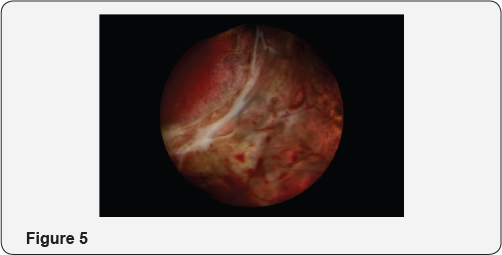 Click here to view Large Figure 1