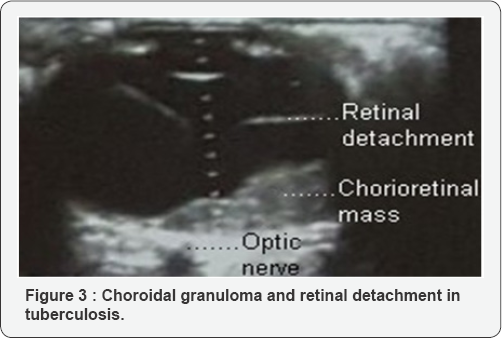 Click here to view Large Figure 3