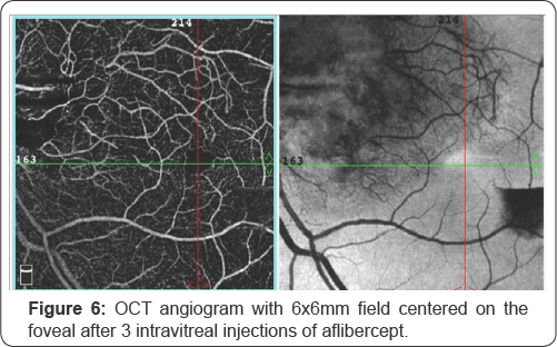 Click here to view Large Figure 6