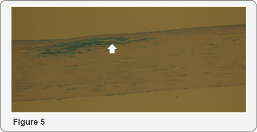 Click here to view Large Figure 5