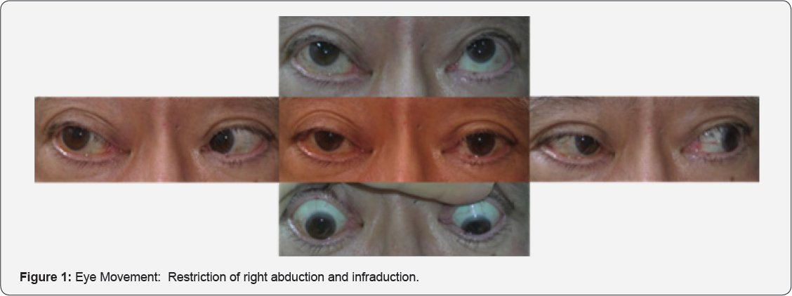 Click here to view Large Figure 1