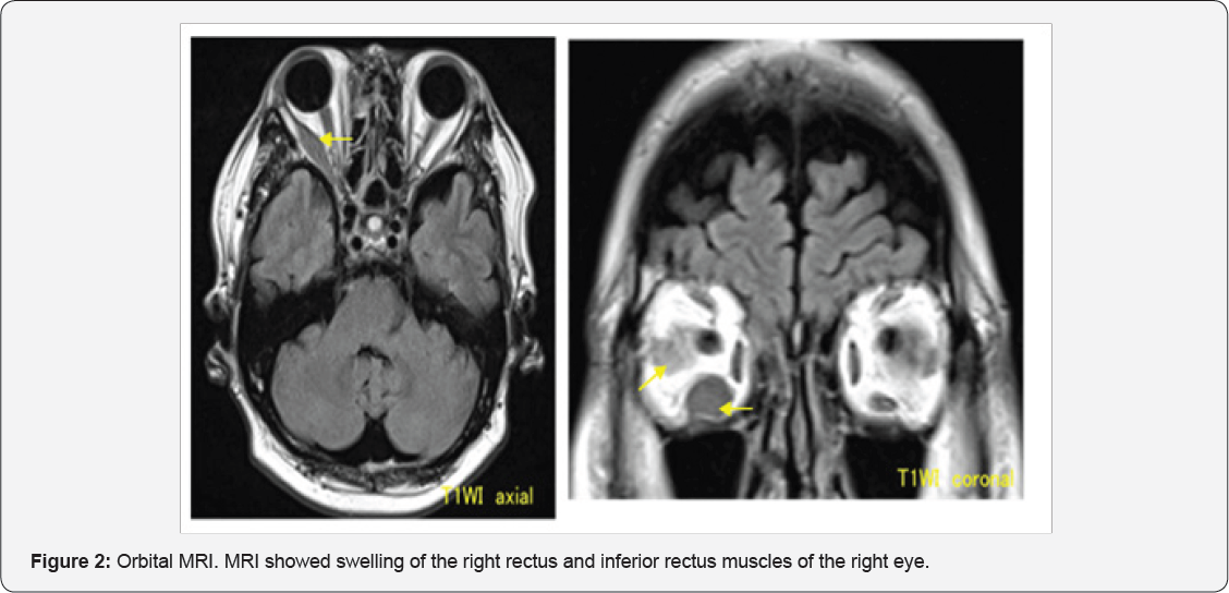 Click here to view Large Figure 1