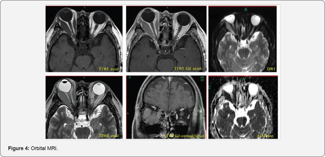 Click here to view Large Figure 1