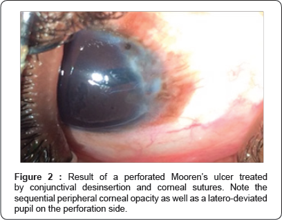 Click here to view Large Figure 2