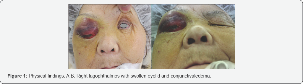 Click here to view Large Figure 1