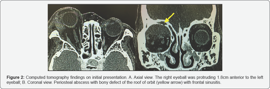 Click here to view Large Figure 2