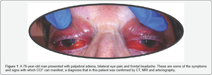 Click here to view Large Figure 1