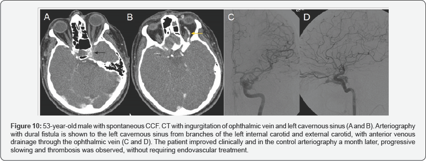 Click here to view Large Figure 10