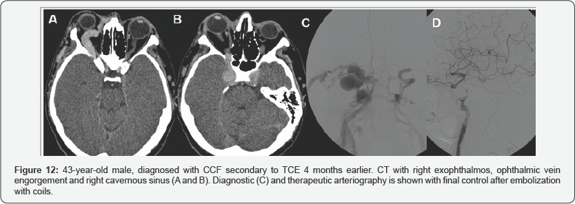 Click here to view Large Figure 12