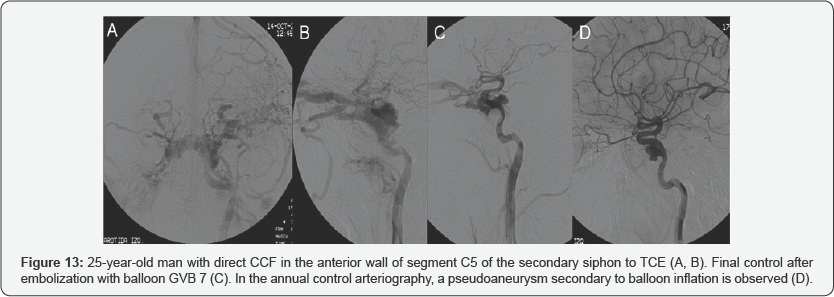 Click here to view Large Figure 13