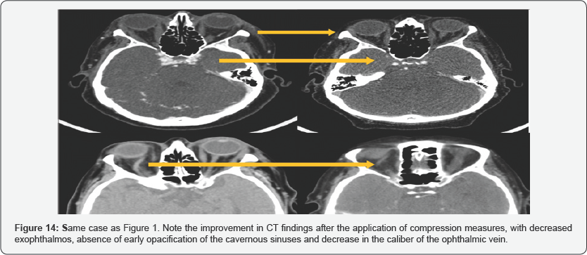 Click here to view Large Figure 14