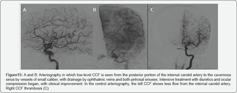 Click here to view Large Figure 15
