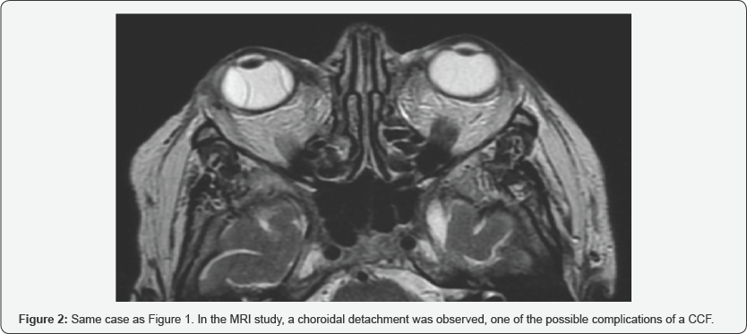 Click here to view Large Figure 2