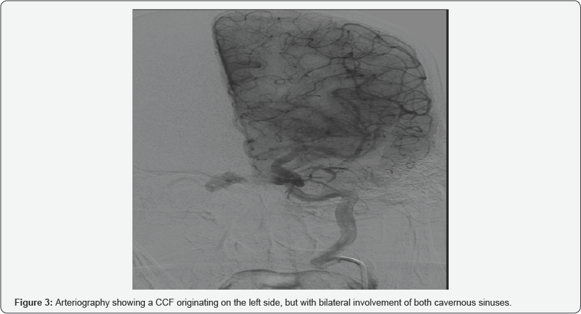 Click here to view Large Figure 3