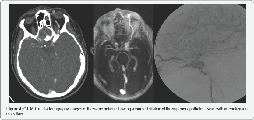 Click here to view Large Figure 4