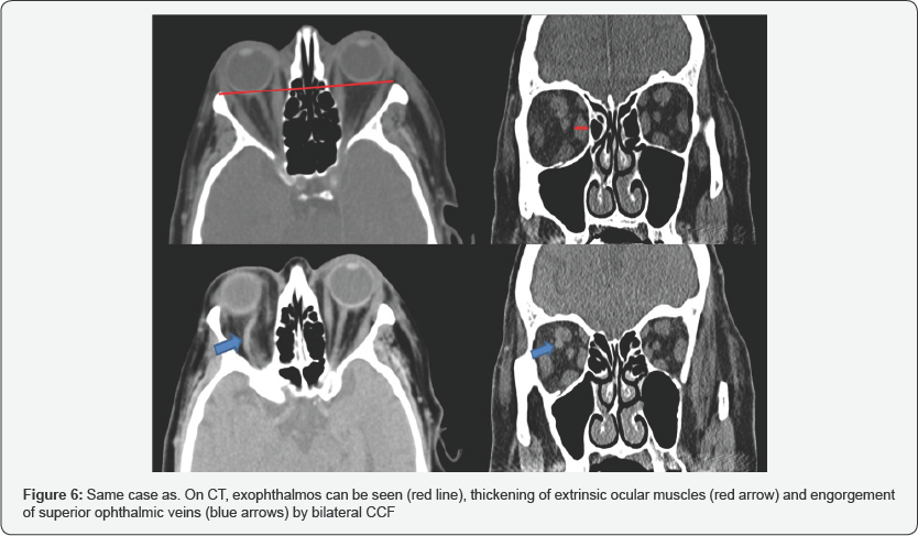 Click here to view Large Figure 6