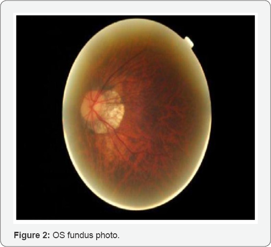 Click here to view Large Figure 2