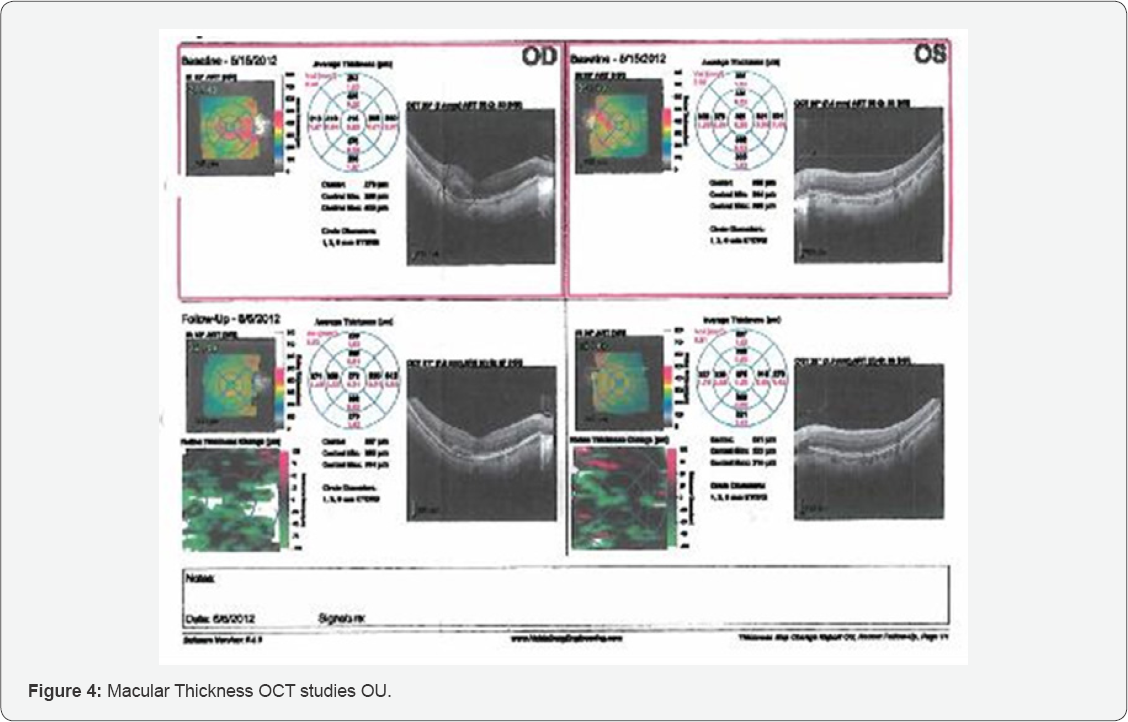 Click here to view Large Figure 4