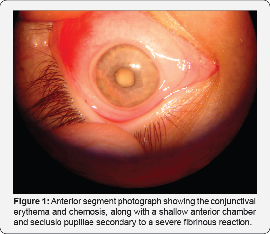 Click here to view Large Figure 1