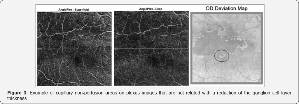Click here to view Large Table 3