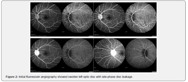 Click here to view Large Figure 2
