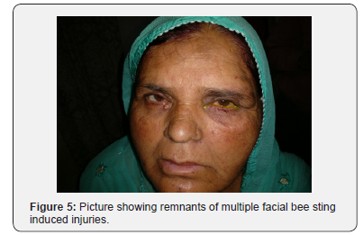 Click here to view Large Figure 5