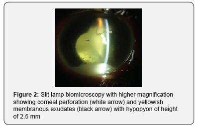 Click here to view Large Figure 2