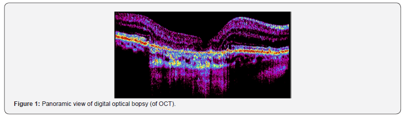 Click here to view Large Figure 1