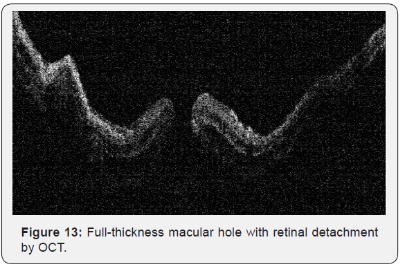 Click here to view Large Figure 13