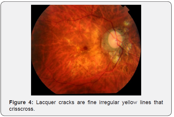 Click here to view Large Figure 4