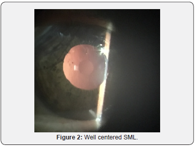 Click here to view Large Figure 2