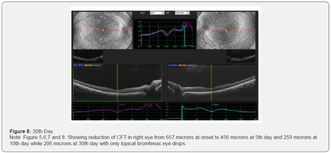 Click here to view Large Figure 8 JOJ Ophthalmology