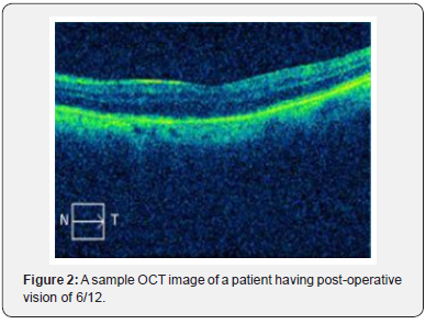 Click here to view Large Figure 2 JOJ Ophthalmology